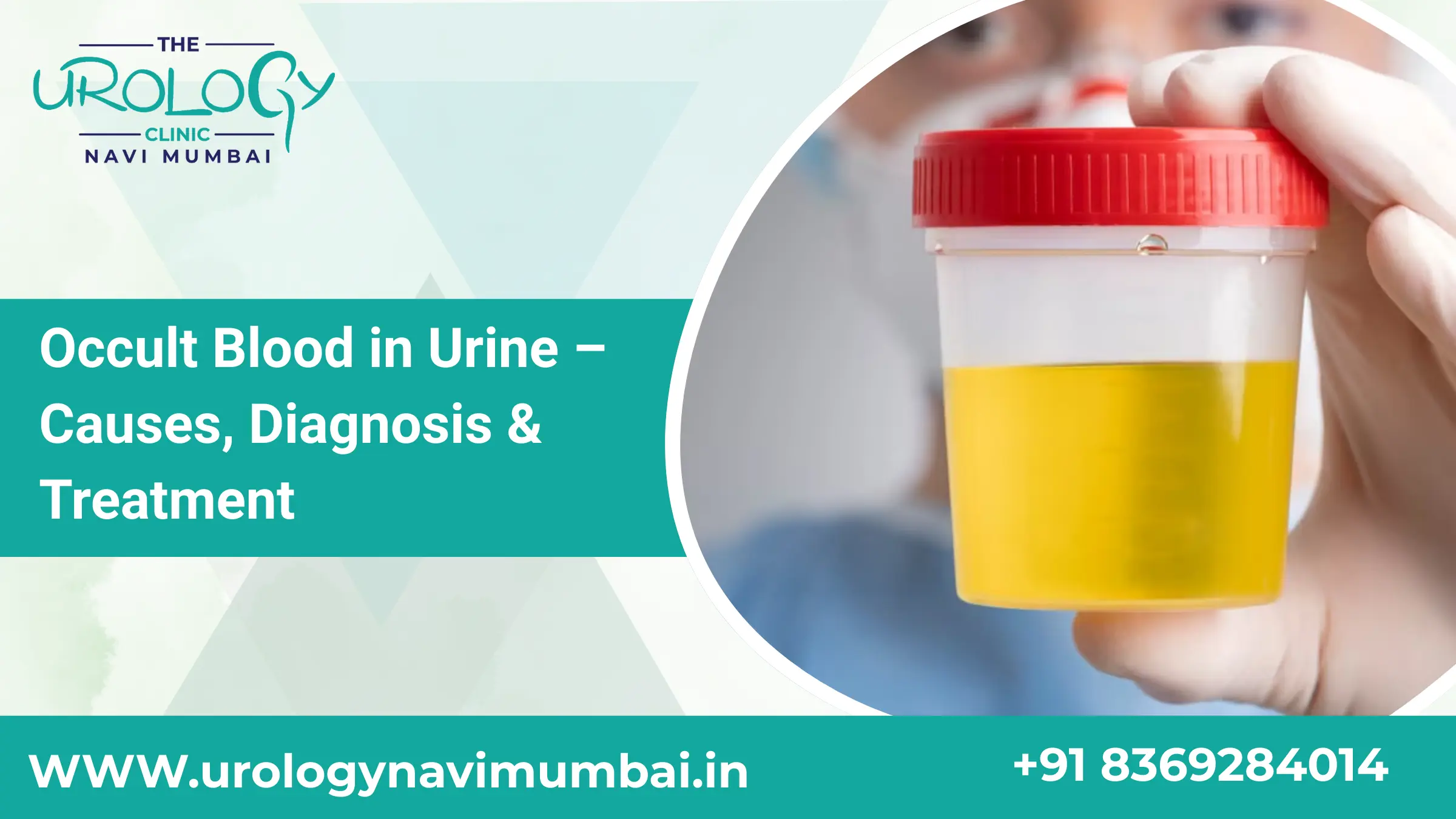Occult Blood in Urine: Causes, Diagnosis & Best Treatments - Dr ninad ...