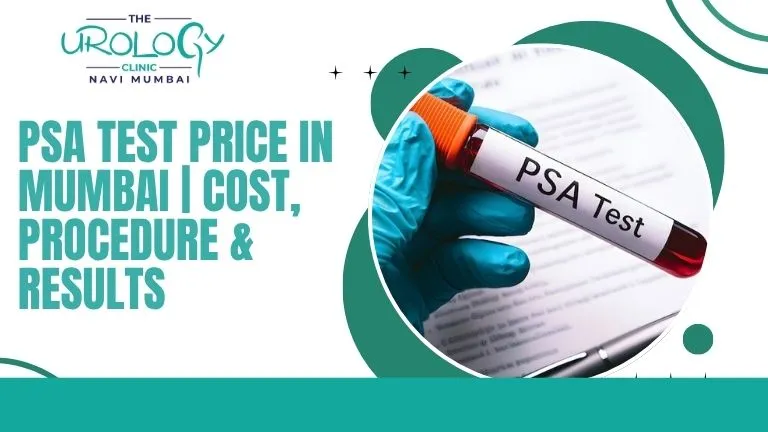 PSA Test Price