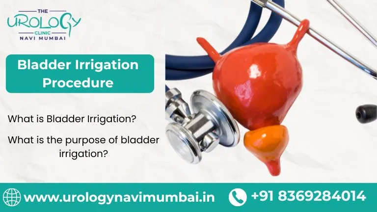 Bladder Irrigation Procedure
