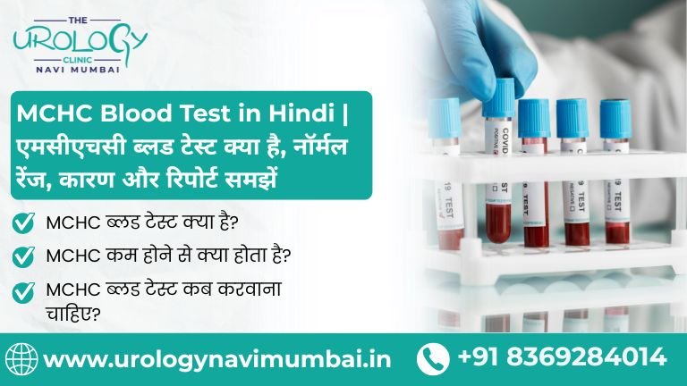 MCHC Blood test