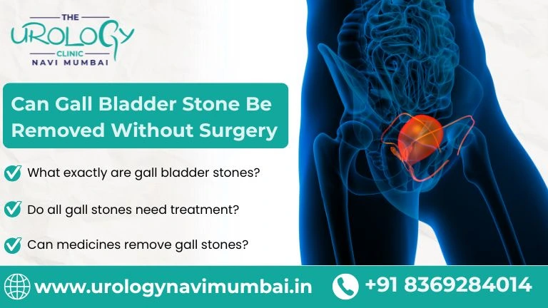 can gall bladder stone be removed without surgery​