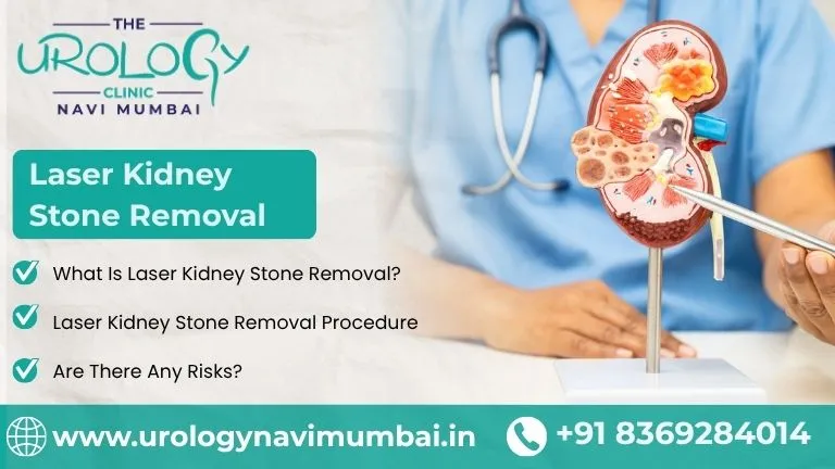 Laser Kidney Stone Removal