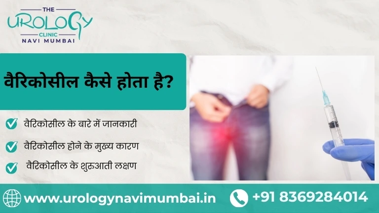 वैरिकोसील कैसे होता है? कारण, लक्षण और उपचार की पूरी जानकारी