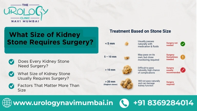 What Size of Kidney Stone Requires Surgery?