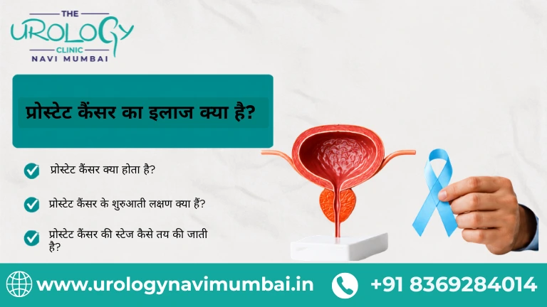 प्रोस्टेट कैंसर का इलाज क्या है?